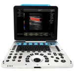 15" LED Color Doppler