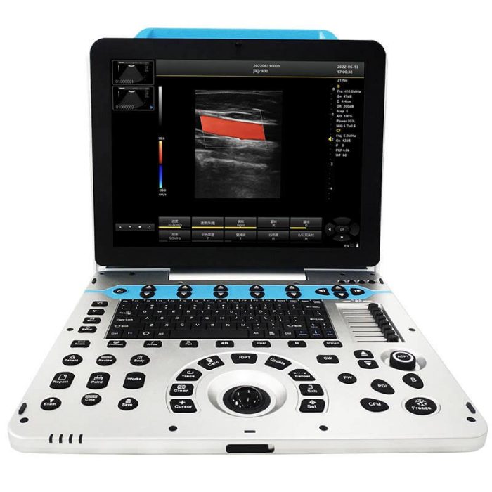 15" LED Color Doppler
